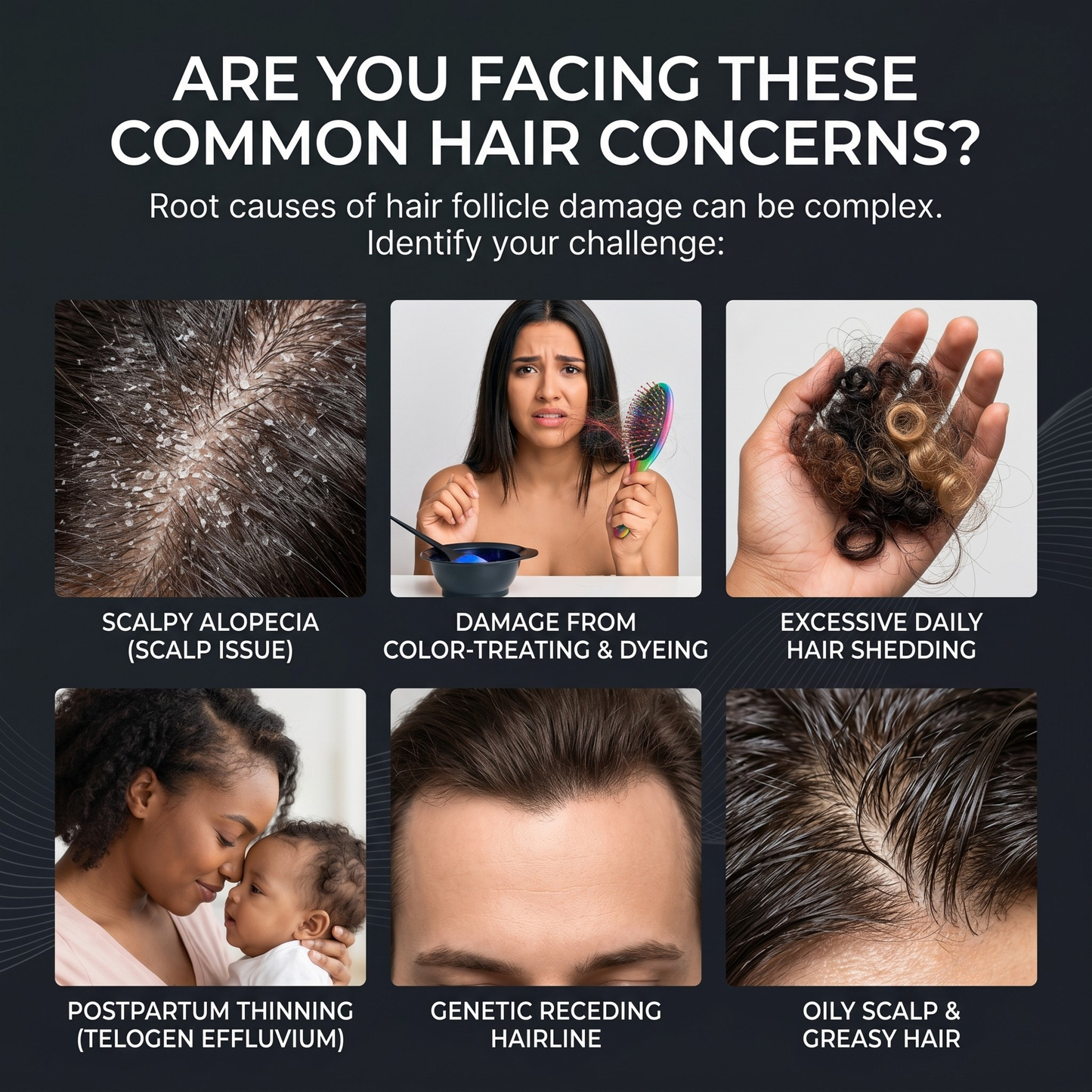 Folivia X Essential™ Hair Growth System – FDA-Cleared Laser Technology