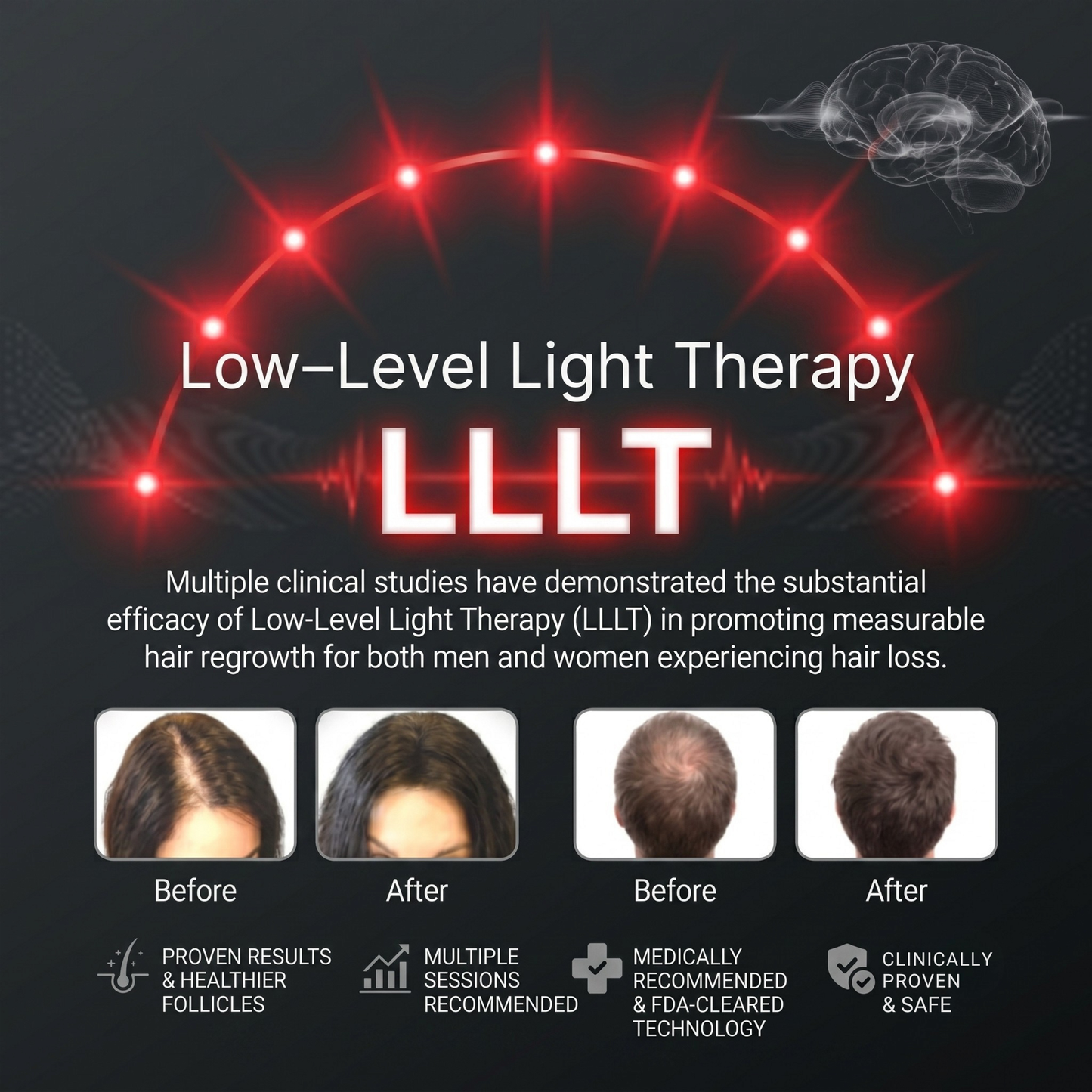 Folivia X Essential™ Hair Growth System – FDA-Cleared Laser Technology
