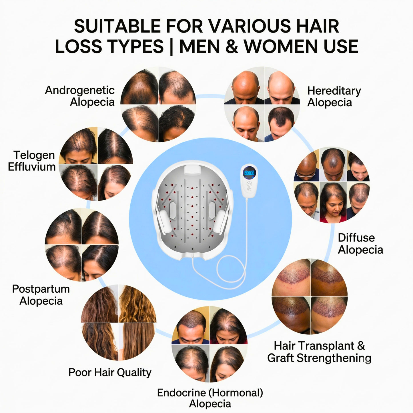 Folivia X Essential™ Hair Growth System – FDA-Cleared Laser Technology