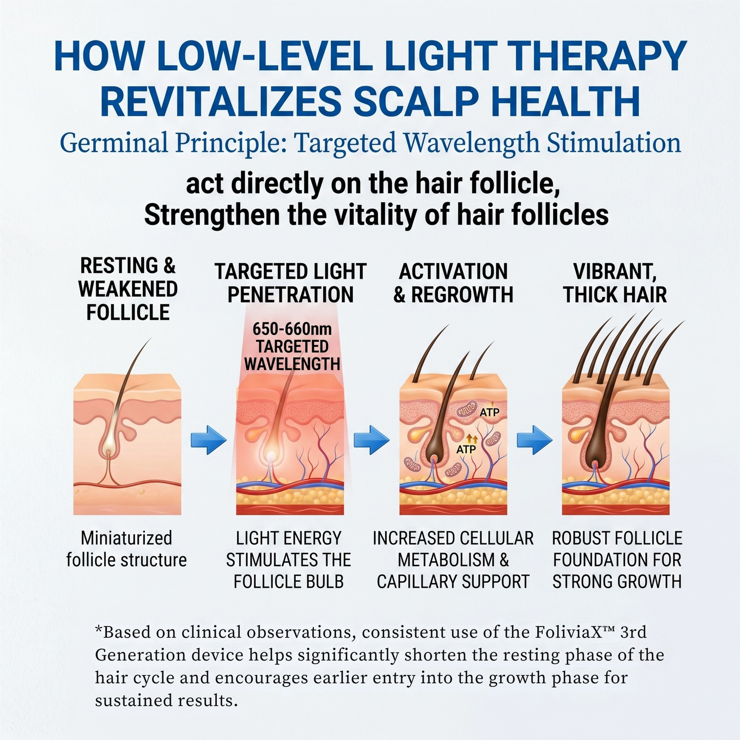 Folivia X Pro™ – FDA-Cleared 162-Laser Hair Growth System