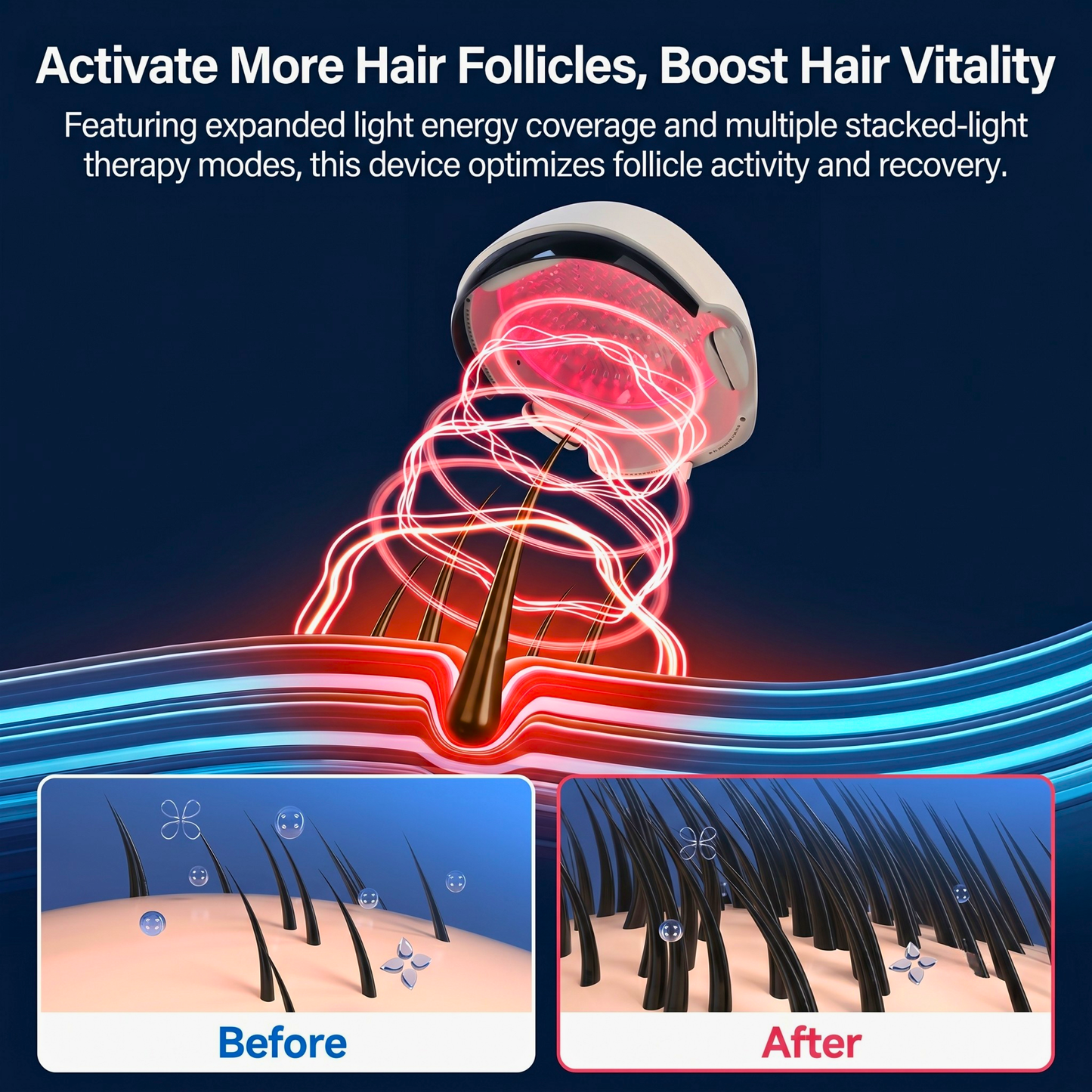 Folivia X Pro™ – FDA-Cleared 162-Laser Hair Growth System